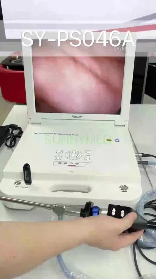 Caméra d'endoscope d'arthroscopie de système d'endoscope entièrement HD